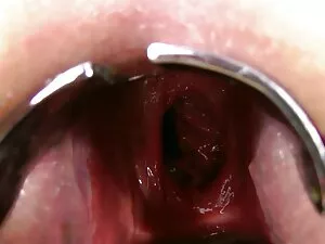 Inflação video sexo  ...